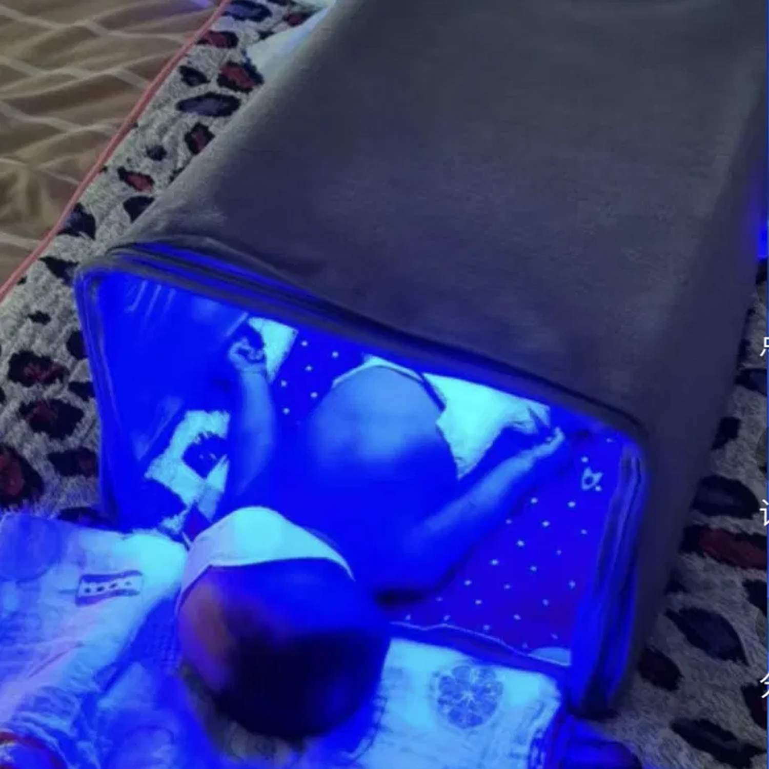 Лампа от желтушки кювез