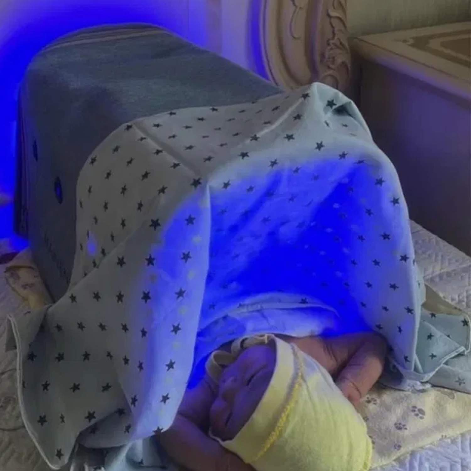 Лампа от желтушки кювез