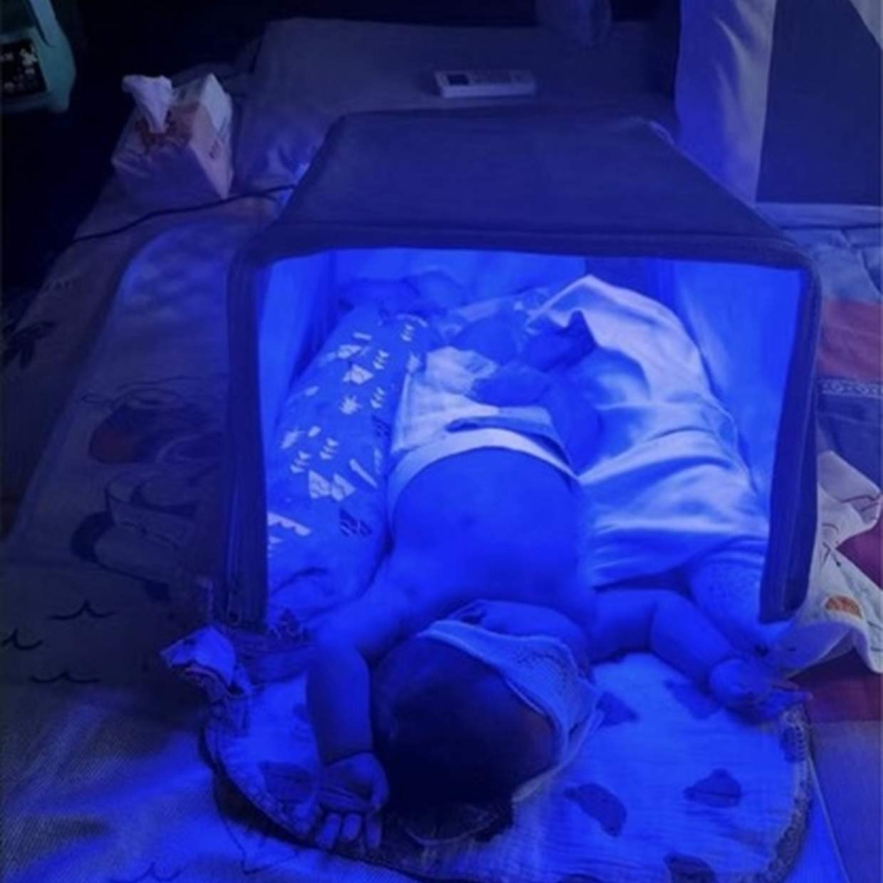 Лампа от желтушки кювез